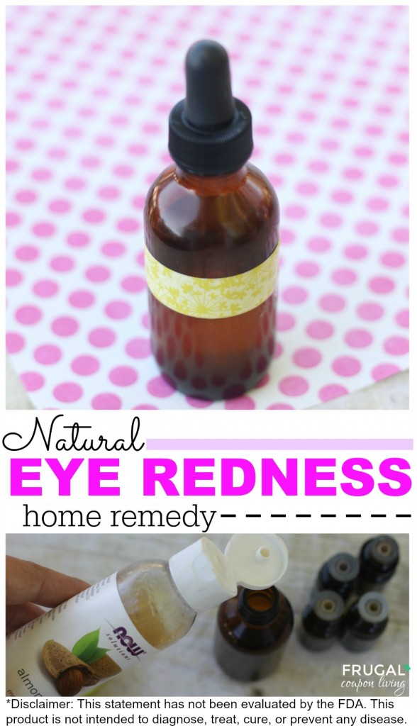 natural-eye-redness-essentail-oils